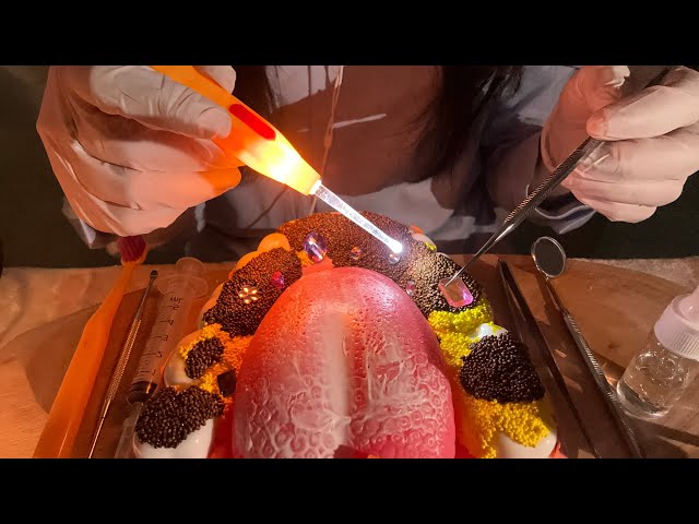 Dental ASMR 🦷 Extreme Tartar Removal Tingle Roleplay