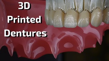 3D Printed Dentures - What, Why, How?
