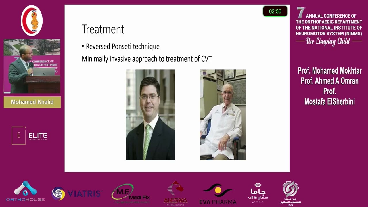 Day2 session 3.3 Reversed ponseti in managment of vertical talus - Mohamed Khalid 