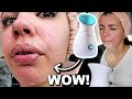 I Tested The Best FACIAL STEAMER On Amazon!