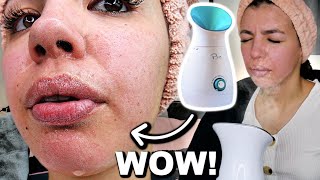 I Tested The Best Facial Steamer On Amazon