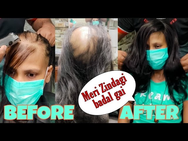 Hair Wig For Women | Women wigs | front lace women wig | Hair extensions  for ladies | women toppers - YouTube