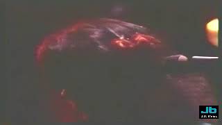 Linda Ronstadt - Someone To Lay Down Beside Me (Offenbach, Germany - 1976) chords