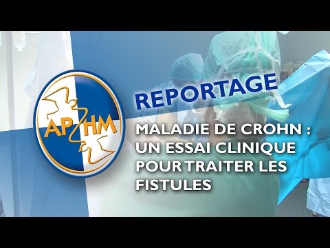 Vidéo: Complications De La Maladie De Crohn: Fistules Et Plus