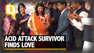 Acid Attack survivor finds love and gets engaged | The Quint