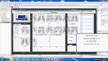 Matlab code for Recognizing Common CT Imaging Signs