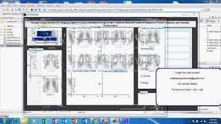 Matlab code for Recognizing Common CT Imaging Signs