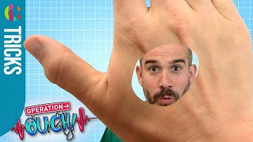 Hole In Your Hand Trick | Operation Ouch!