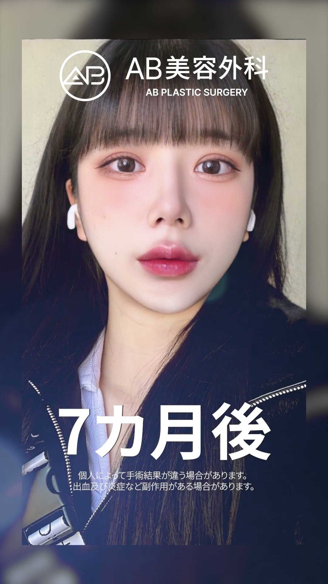 美しさへの変身: 自然から驚きの美しさへ | AB整形外科 #韓国整形 #美容