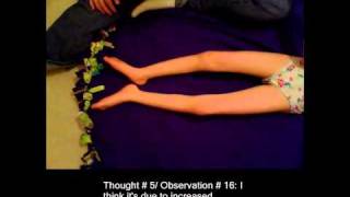 Hipssubluxation01.Div