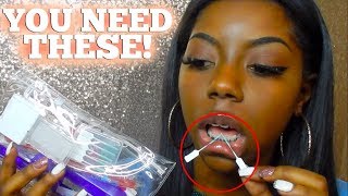 Braces Essentials | things i cant live without!