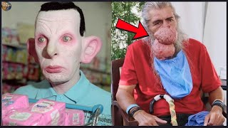 15 Most Bizarre People You Won't Believe Actually Exist! | Then and Now 2026