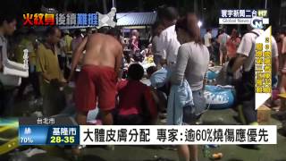 寰宇新聞  大體皮膚分配 專家:逾60%燒傷應優先 20150706