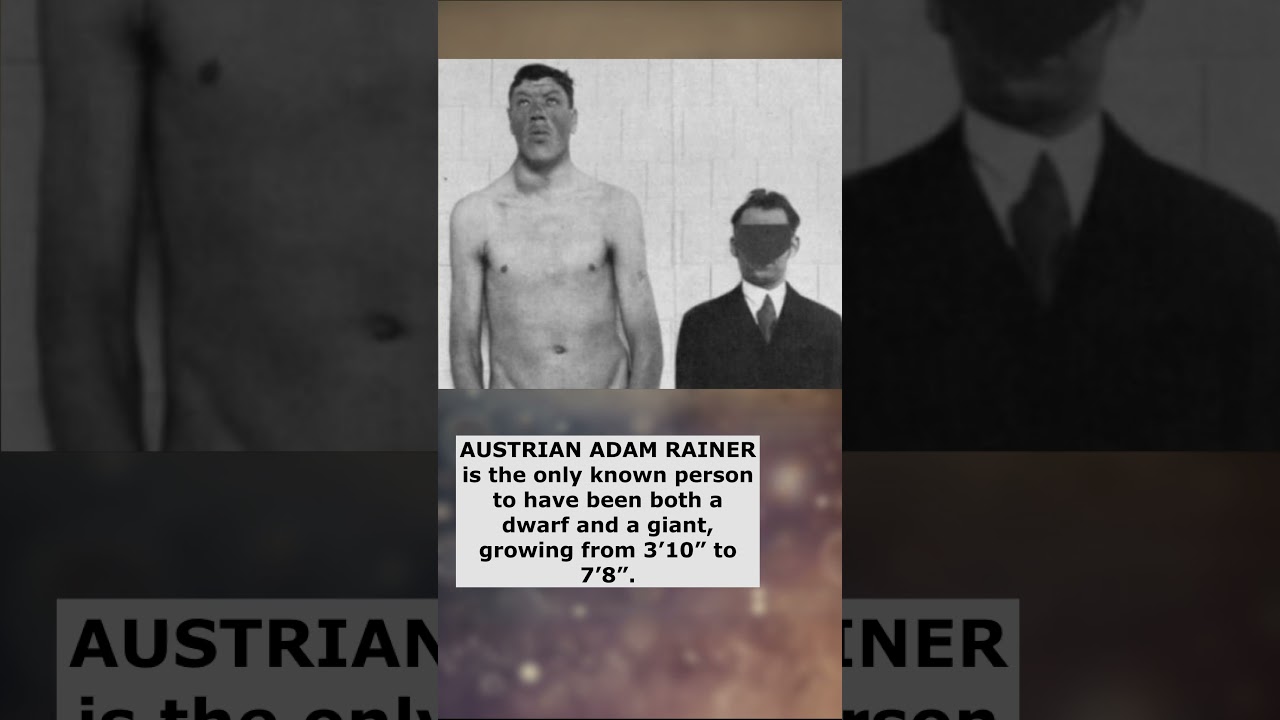 Dwarf-Giant Man, Insanity Masks & Post-War - Creepy Smart Facts 