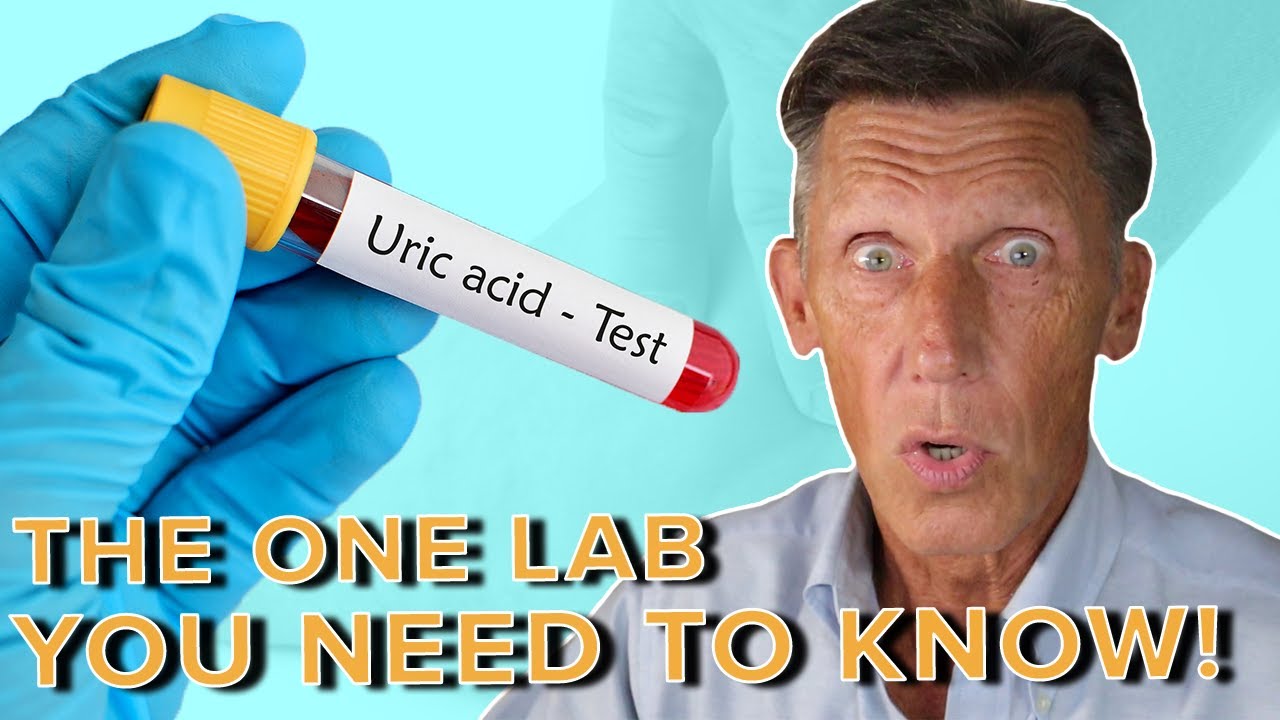 The 1 Lab You need to Know NOW! Uric Acid YouTube