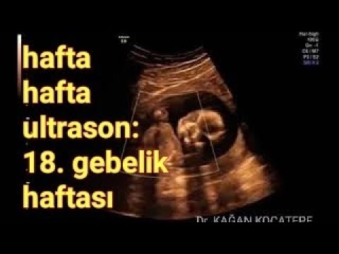 18 gebelik haftasinda anne karnindaki bebek hareketler hangi haftada baslar ve hissedilir youtube