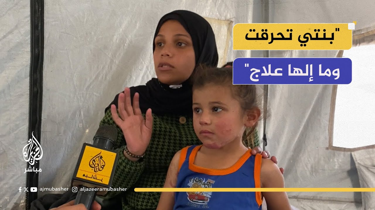 طفلة مصابة بحروق خطيرة بلا علاج داخل غزة