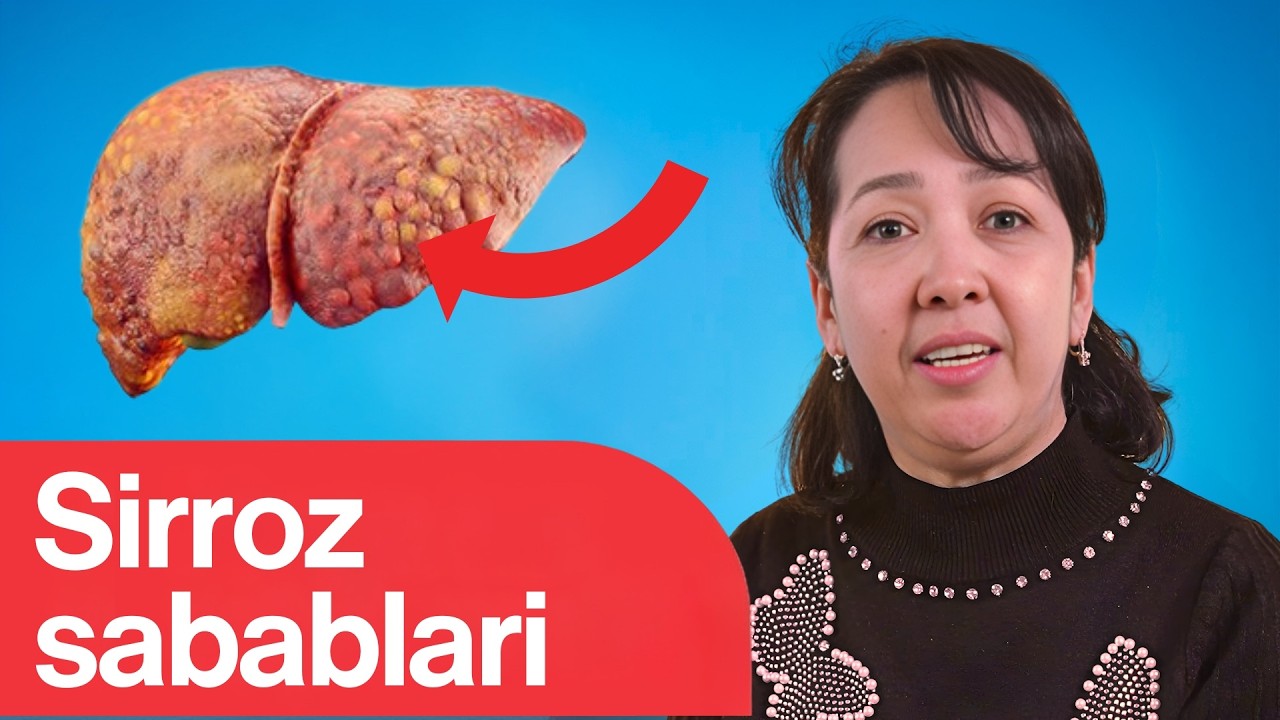ЖИГАР СИРРОЗИ қандай касаллик, сабаблари, белгилари ва даволаш