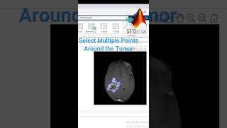 Extract Tumor by Image Segmentation MATLAB- DICOM image screenshot 4