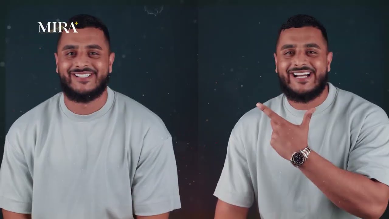 ابتسامة هوليود في تركيا vs المملكة المتحدة 2026: تجربة سام ماكسويل مع الفينير الطبيعي في إسطنبول