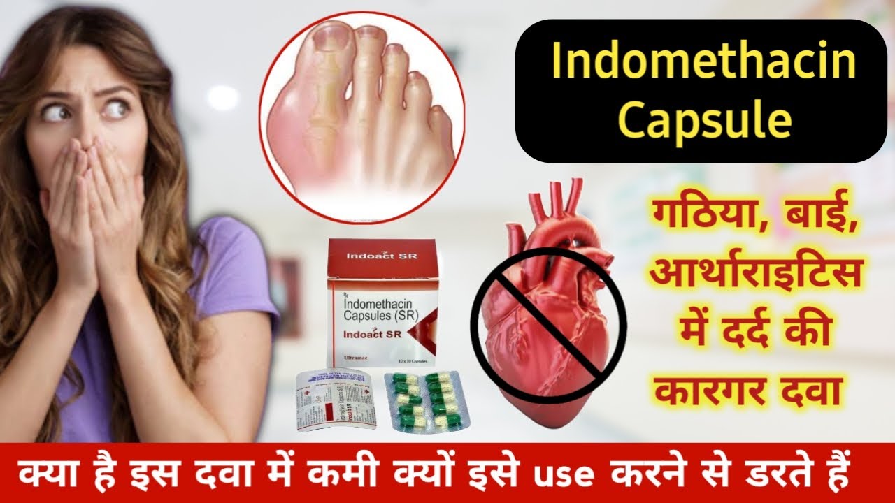 Indomethacin Capsule uses | Treatment of arthritis and gout | गठिया का इलाज़ कैसे करे