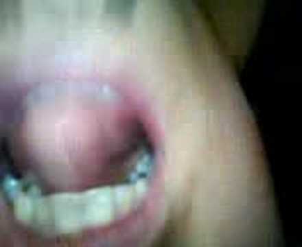 brenda godwin chin head