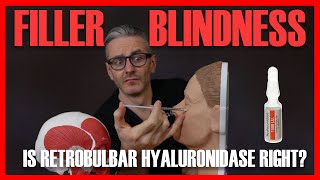 FILLER BLINDNESS: Should you do retrobulbar hyaluronidase injection? [Aesthetics Mastery Show]