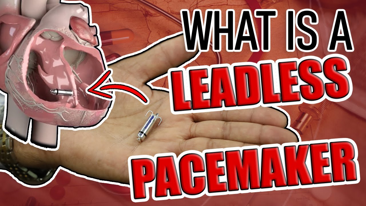 What Is A Leadless Pacemaker YouTube What Is A Leadless Pacemaker YouTube