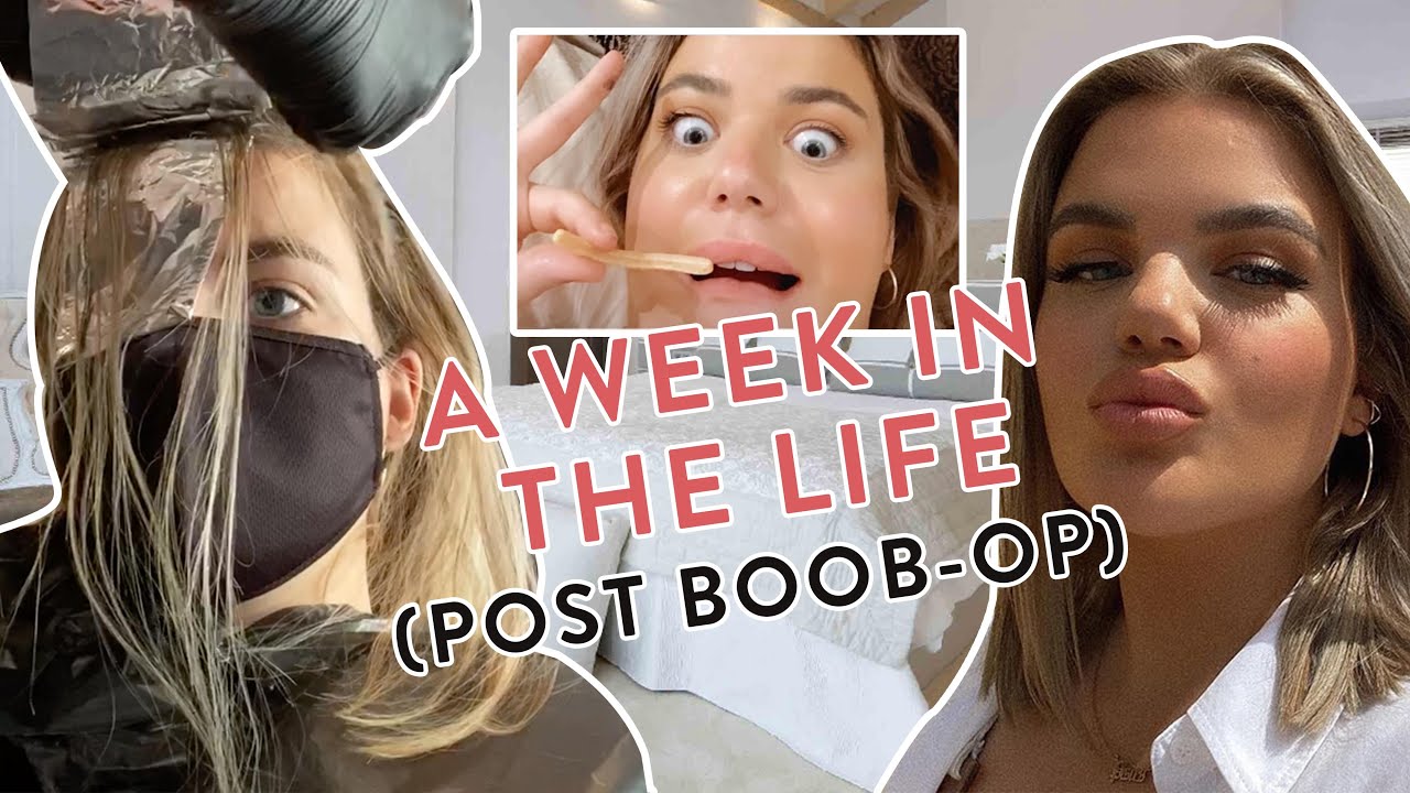 A WEEK IN THE LIFE IN MARBELLA (RECOVERING FROM BOOB SURGERY) YouTube