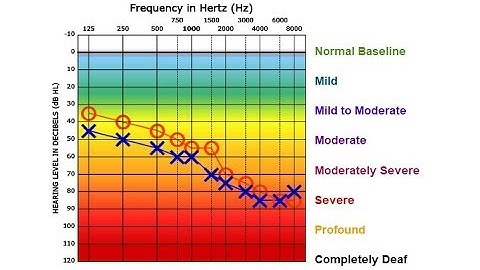 Audiogram UCL Tone