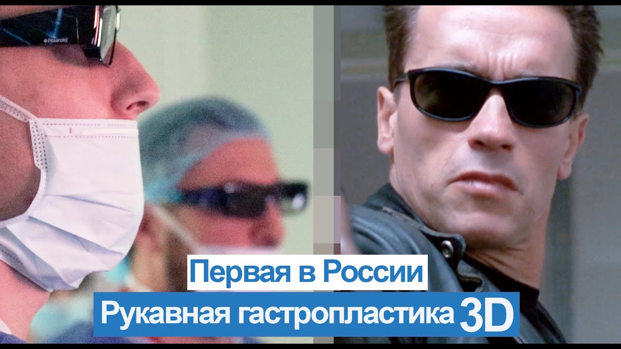 Рукавная гастропластика 3D. Впервые в России! - YouTube