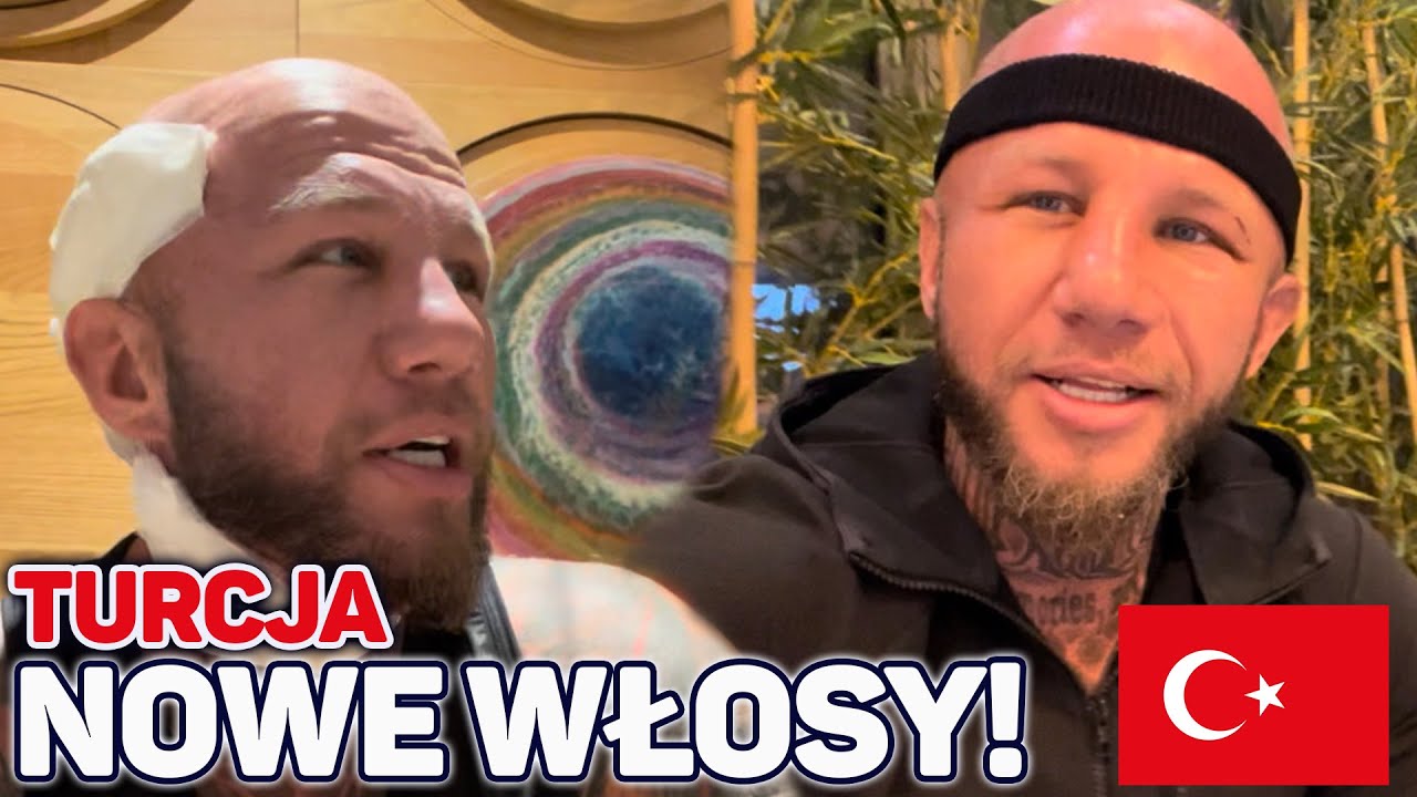 #24 Przeszczep włosów w Turcji (Istambuł) Pokaże wam jak to wygląda. (Flymedica)