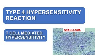 Type 4 Hypersensitivity Reactions | Made easy | Mechanism & Examples | Images