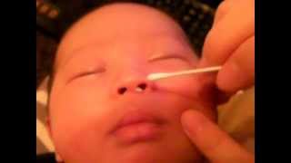 赤チャンネル 赤ちゃんの鼻くそ撤去術 Youtube