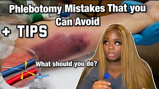 Phlebotomy Mistakes | THAT YOU CAN AVOID + Tips