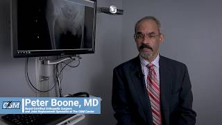 Treatment Options for Hip Arthritis Peter Boone MD