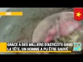 Grace à des milliers d’asticots dans la tête, un homme a pu être sauvé.