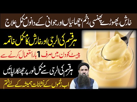 How To Remove Skin Problem Free At Home Made Remedy Allergy Ka Ilaj Kharish Ka Ilaj Dr Sharafat Ali