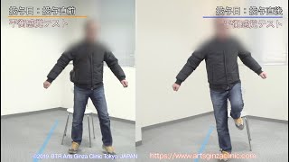 Case-8 ：40代男性 小脳出血後1年半 構音障害･平衡感覚不全･歩行障害 幹細胞投与当日の記録  BTR ArtsGinzaClinic StemCell therapy Case8