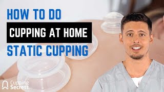 How to Do Cupping at Home - Static Cupping