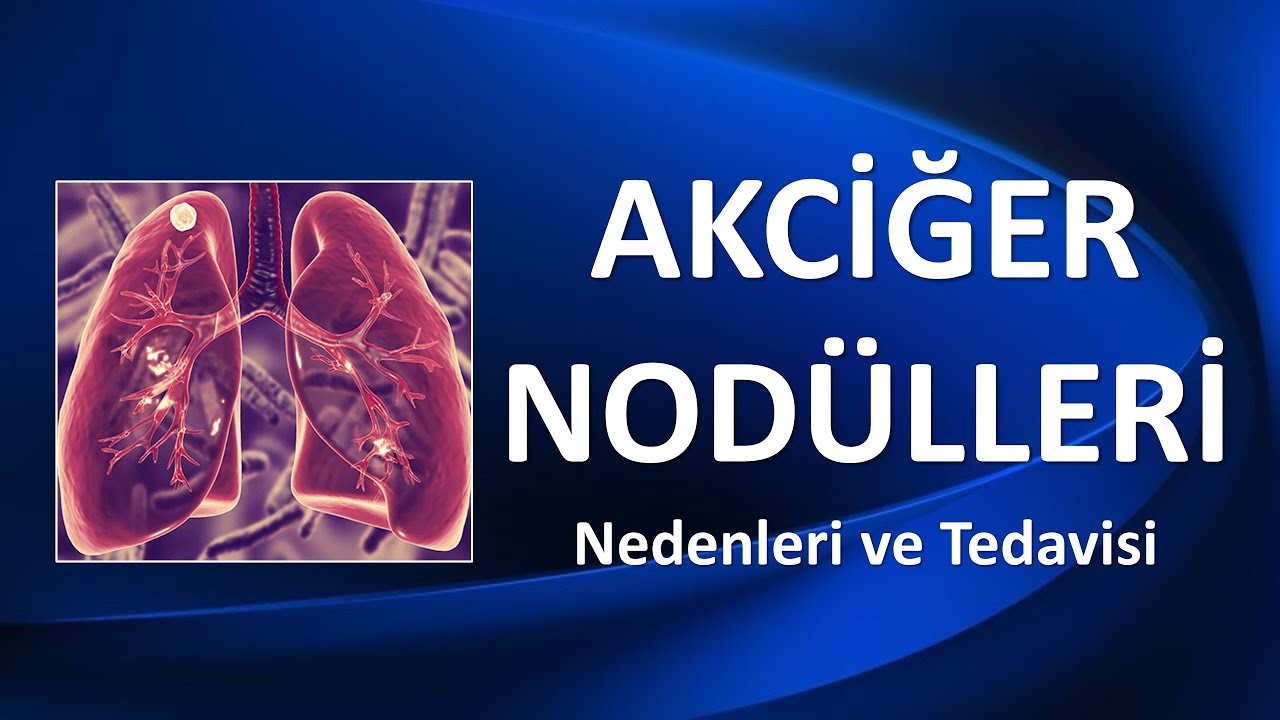 AKCİĞER NODÜLLERİ Nedenleri ve Tedavisi