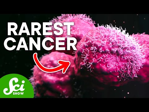 The Rarest Cancer on Earth: Only One Known Case thumbnail