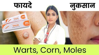 Thuja Ointment Cream Uses & Side Effects Thuja Cream For Moles Removal, Warts Remover Ointment