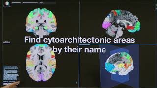 Navigate complex neuroanatomy and integrate neuroscience data using 3D brain atlases. Part 4