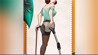 The Beautiful Woman Is An Amputee And Lives With An Artificial Leg