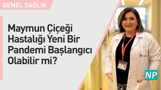 Maymun Çiçeği Hastalığı Yeni Bir Pandemi Başlangıcı Olabilir mi?