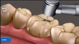 Clean teeth craze 😁  dentist games 3d game #gamingvideos #gaming screenshot 1