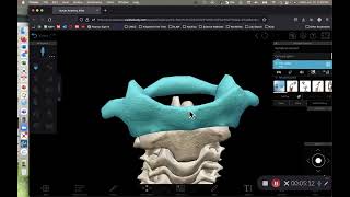 BIOL 214 Lab Exercise 9 Bones of Vertebral Column