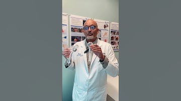How Implant Quality Impacts Shoulder Surgery Outcomes