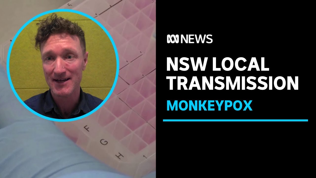 Monkeypox: NSW records its first known case of local transmission | ABC ...